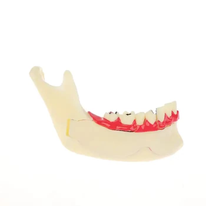 Modèle de traitement endodontique dentaire, anatomie des gencives, tissu Mandible, modèle anatomique, dentiste, enseignement, étude, démonstration, modèle de dents