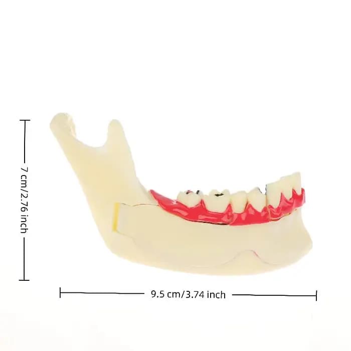 Modèle de traitement endodontique dentaire, anatomie des gencives, tissu Mandible, modèle anatomique, dentiste, enseignement, étude, démonstration, modèle de dents