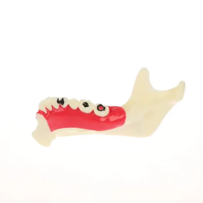 Modèle de traitement endodontique dentaire, anatomie des gencives, tissu Mandible, modèle anatomique, dentiste, enseignement, étude, démonstration, modèle de dents