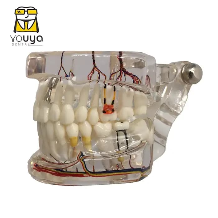 Réparation neurale des dents, modèle pathologique d'implant dentaire, dentiste, étudiants, Communication, apprentissage, recherche, enseignement des maladies buccales